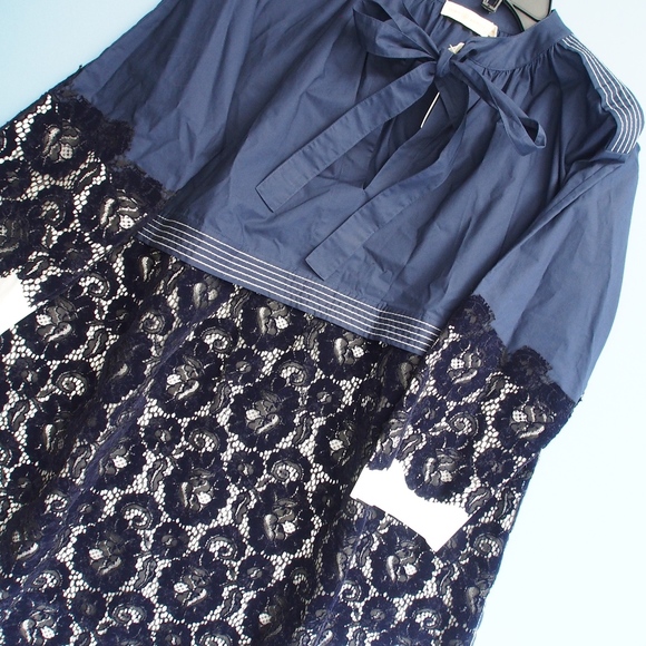 Tory Burch Adelaide Lace Dress Runway 2018- XS - Picture 2 of 7